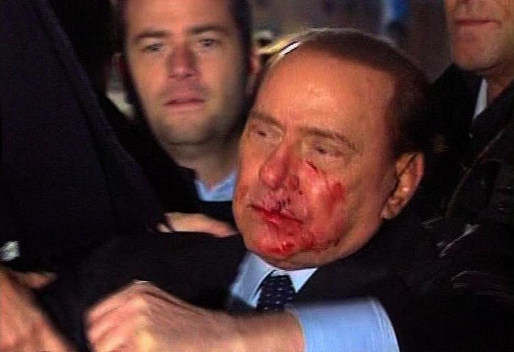 Overfaldet. Silvio Berlusconi umiddelbart efter overfaldet. Billederne stammer fra den italienske tv-station RAI. 