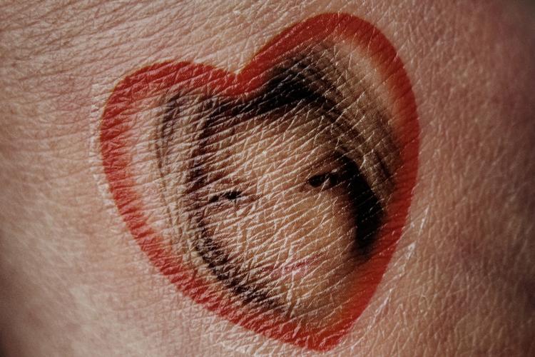 På grund af fotokontrakt har danske og svenske fotografer valgt ikke at fotografere koncerten. Billedet af Britney her sidder på en fans arm. 