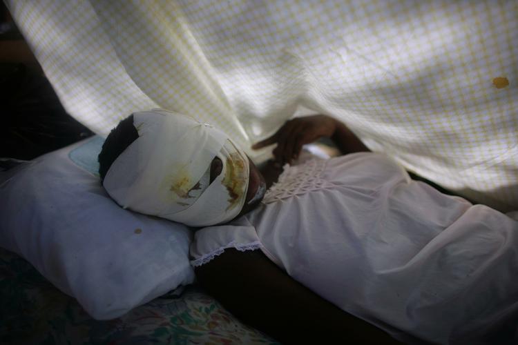 En såret kvinde på et hospital - her dog i Port-au-Prince. I Leogane kommer der stadig flere sårede til Læger Uden Grænsers felthospital. 