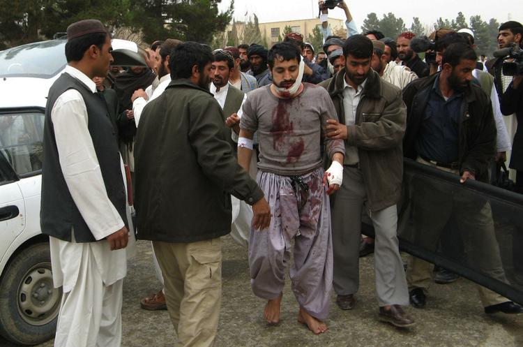 Kvæstet. Blandt de sårede fra bomben var denne mand, der blev ramt, mens han overværede en hundekamp. 