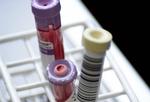 Bloddonor
