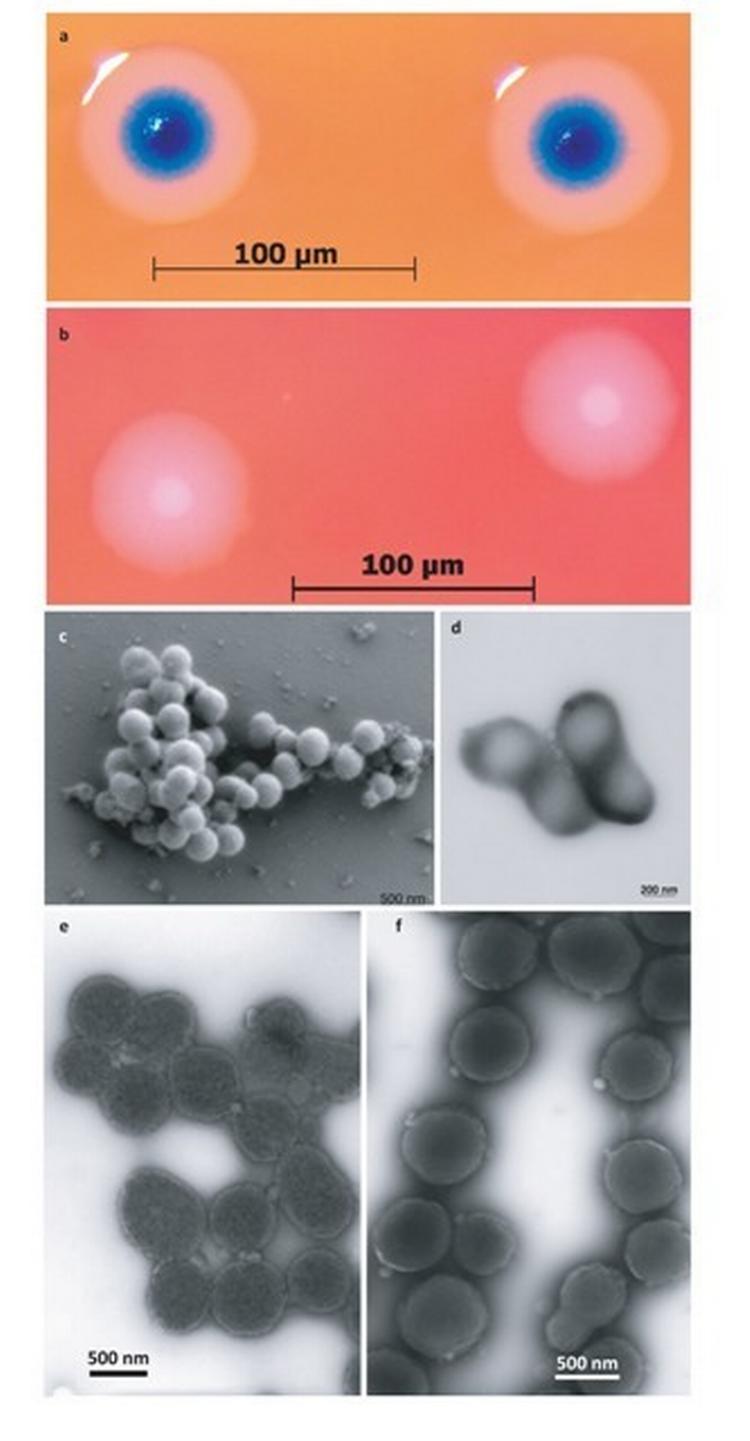 De blå kolonier er et tegn på, at det kunstige genom får bakterien til at vokse og reproducere sig selv på helt samme måde som en naturlig bakterie af arten mycoplasma mycoides ville gøre det. Nr. tre fra toppen og til venstre (det med de mange små kugler):De selvkopierende nyskabte bakterier fotograferet gennem mikroskop.Fotos: Science/AAAS 