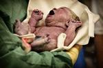 Kejsersnit