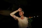 Blå mærker. Aktivisterne påstår, at de israelske myndigehder har givet dem en særdeles hårdhændet behandling under tilbageholdelsen. 