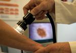 Hudkræft. Forstadier til hudsygdommen pladecellekræft kan nu behandles med en ny plantemedicin. 