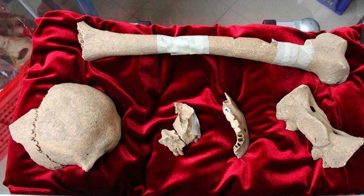 Mens politikerne slås om hans sidste hvilested, ligger Caravaggios ben nok så nydeligt på lit de parade på en rød silkepude i den norditalienske by Ravenna, hvor de for tiden udstilles. 