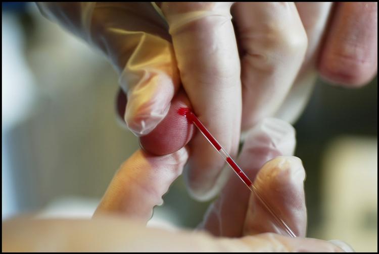 En patient får målt sit kolesteroltal. Den store Herlev/Østerbro-undersøgelse, hvor omkring 75.000 danskere har fået målt deres triglycerid-tal, viste, at hver femte kvinde og mere end hver tredje mand havde for meget af det farlige blodfedt. 