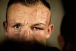 Mikkel Kessler