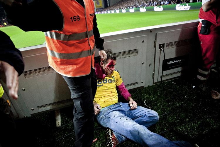 Vold. I slutningen af kampen i Parken mellem Brøndby og FCK kæmpede flere hundrede brøndbyfans med politiet. Her er en, der kom galt afsted. 