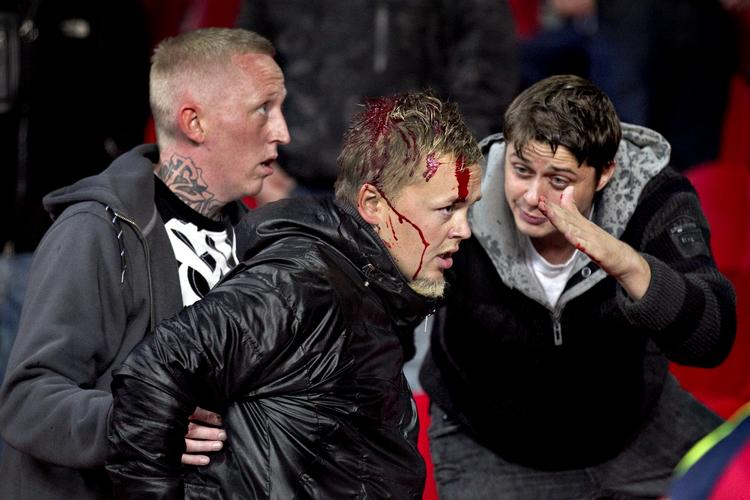 Fodboldvold. En fodboldtilhænger slået til blods på D-tribunen i Parken. Det bør undersøges, hvordan det kom så vidt, siger forsker. 