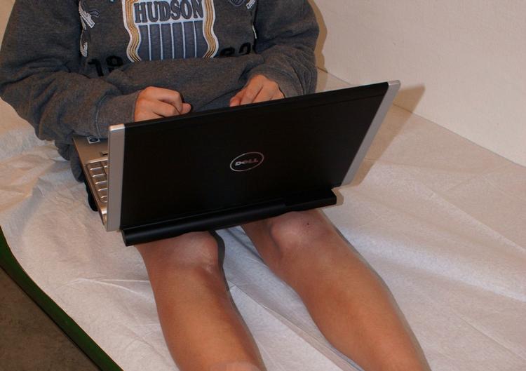 Temperaturen på en bærbar computers underside kan komme op på 52 grader, og over længere tid vil huden tage skade af varmen, viser det sig. 
