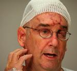 Overlever. John Chelminiak fortæller om, da han blev mishandlet af en sulten hunbjørn. Han er stadig under behandling på Harborview Hospital i Seattle Washington. 