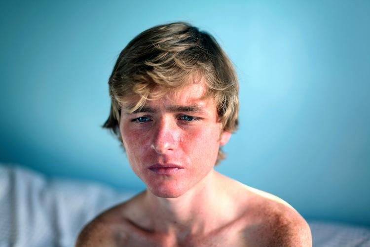 Laura Pannacks billede af den anoreksiramte Graham vandt 1. prisen i portrætgenren ved årets World Press Photo. 