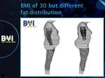 Fedtfordeling. Begge disse personer har et BMI på 30 - men med forskellig fedtfordeling.Personen til venstre har fedtet på maven, og det er farligst. Netop mavefedtet tages der højde for i den nye BVI-måleteknik. 