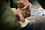 Et nyt lille barn kommer til verden på Hvidovre Hospital. På billedet er det sket ved kejsersnit. Arkivfoto. 