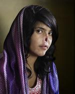 VINDER. Portrættet af den 18-årige afghaner Bibi Aisha er World Press Photo of the Year 2010. 
