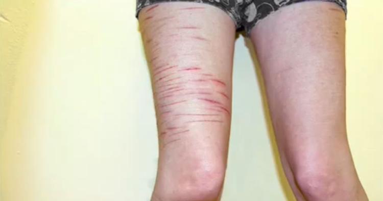 Bo Møhl, der er chefpsykolog på Rigshospitalets psykiatriske afdeling, kalder videoerne et råb om opmærksomhed. Billedet er fra en af videoerne på Youtube. 