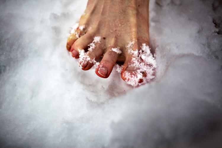 FROSTSKADER. Forhåbentligt bliver det ikke lige så koldt et underlag for løberne, når der er Copenhagen Barefoot Run i maj i Fælledparken. 