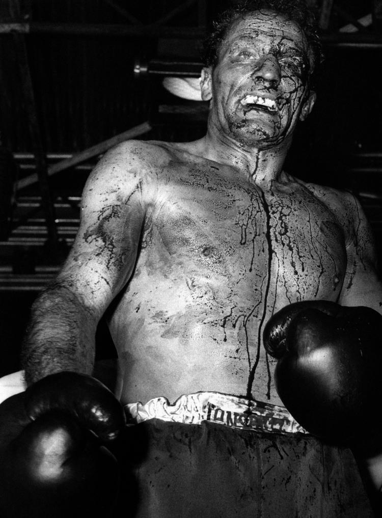 såret. I 1966 var Henry Cooper foran på point, da en flænge over venstre øje stoppede hans kamp mod Muhammad Ali. Foto: AP (arkiv) 