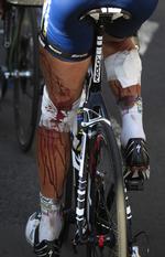 Pigtråd. Hollandske Johnny Hoogerland kom slemt til skade, da en bil ramte ham under dagens Tour-etape og sendte ham ud i et pigtrådshegn. 