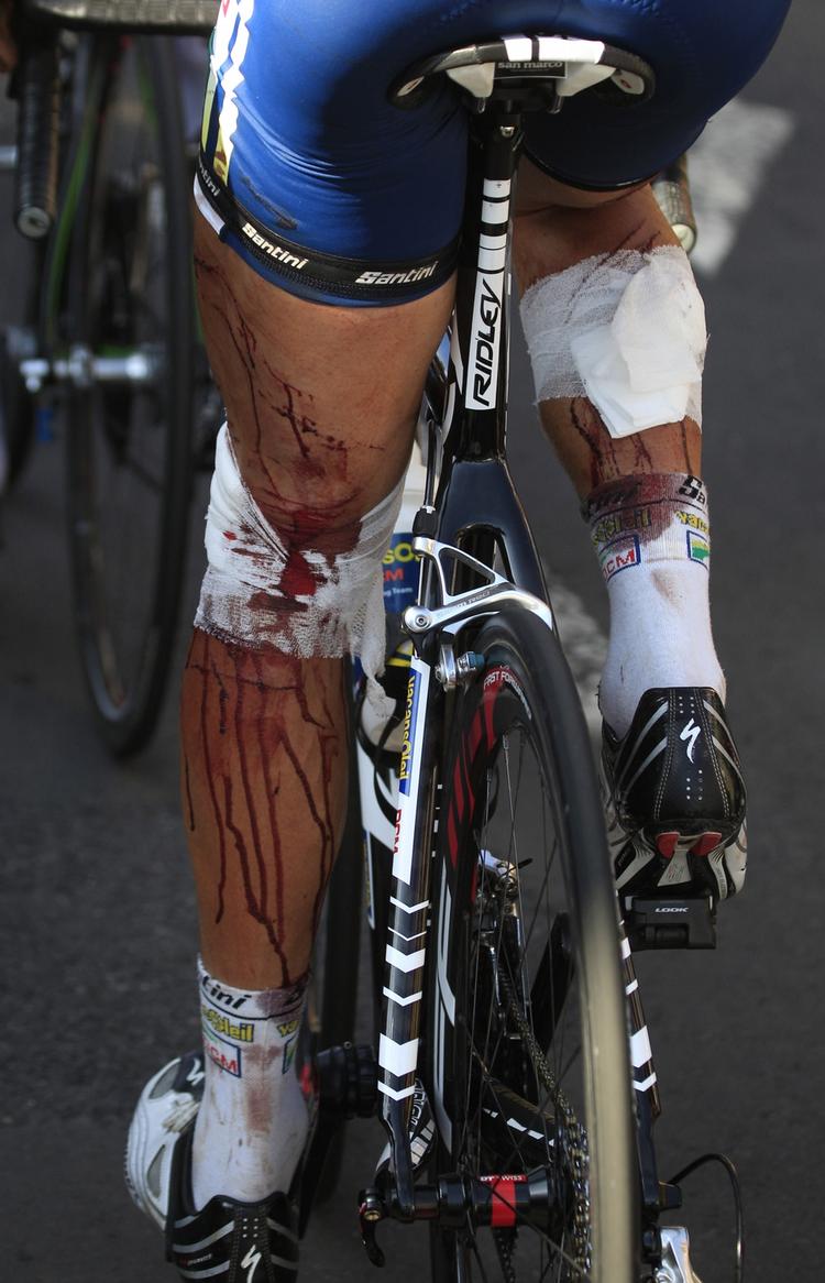 Pigtråd. Hollandske Johnny Hoogerland kom slemt til skade, da en bil ramte ham under dagens Tour-etape og sendte ham ud i et pigtrådshegn. 