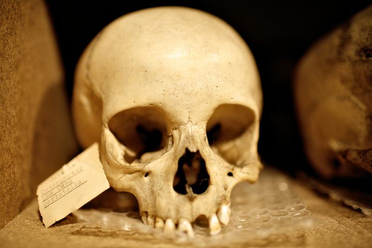 Historie. Skeletterne på Medicinsk Museion i Bredgade overlever den københavnske vandgang som skybruddet den 2. juli bragte med sig. 