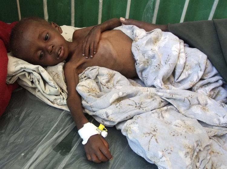 Tørkeoffer. Et alvorligt underernæret barn fra det sydlige Somalia trøstes af sin moders hånd på et hospital i Mogadishu. Det er ofre, som dette barn, danskerne bør give mange flere penge til, mener filosof, der selv giver syv procent af sin løn. 