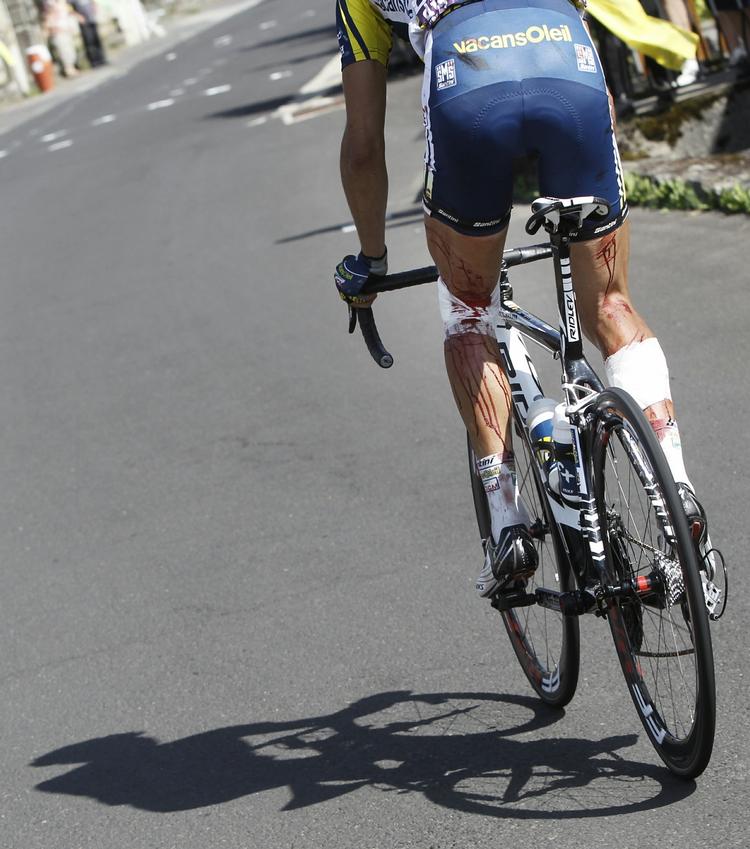 pigtråd. Hollandske Johnny Hoogerland kom slemt tilskade, da han blev fejet af vejen af en ledsagebil under et udbrud i Tour de France. Men hollænderen kom på cyklen i nye cykelshorts og med bandager for at fuldføre løbet. 
