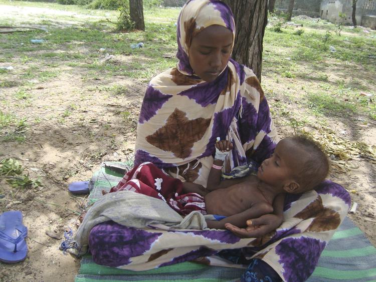 Sult. 11 millioner mennesker på Afrikas Horn har brug for humanitær hjælp. 