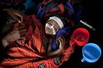 underernæret. Hussein Liban på halvandet år er svært underernæret. Han befinder sig nu på et hospital i en flytningelejr i Dadaab i Kenye nær grænsen til Somalia. Den lille dreng her får proteinvæske gennem næsen hjulpet af sin mor, 30-årige Ibrahini Kapopow. 