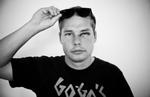 Slået. Shepard Fairey fik et blåt øje og et trykket ribben efter et overfald i København for to uger siden. 
