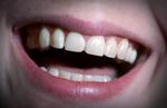 lolbente_sukkerfri_15-10-2011_ITCN3B0.jpg