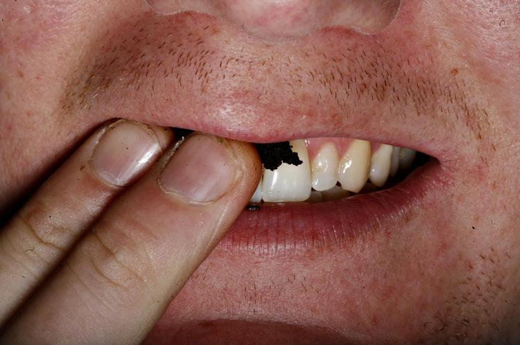 Snus. I Danmark har tobakslovgivningen givet lov til køb af snus i løs mængde, men Bruxelles har indskærpet over for den tidligere regering, at det nu skal være helt slut med snus i Danmark. 