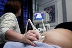 moderlig. Mange danskere opfatter spanierne som gæstfrie og festlige, og de spanske kvinder som feminine og moderlige. Derfor tillægges de spanske kvinders æg en række positive egenskaber, lyder forklaringen på, at mnange danske barnløse par vælger spanske fertilitetsklinikker. 