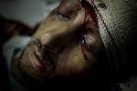 Vinder.  Dette billede af en såret Libysk oprører på et hospital vandt Årets Pressefoto.  Billedet er taget af Mads Nissen fra Berlingske. 