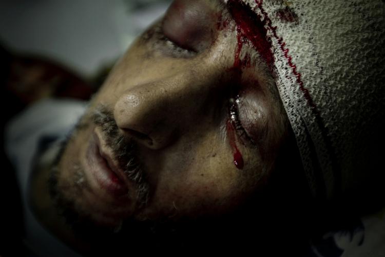 Vinder.  Dette billede af en såret Libysk oprører på et hospital vandt Årets Pressefoto.  Billedet er taget af Mads Nissen fra Berlingske. 