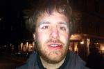 Foto: Maja Lærke Maach. Mads Holscher fik flækket sin læbe, da en betjent slog ham i hovedet med sin politistav. det hvide omkring øjnene er salve, som hjælper mod den peberspray, han også blev ramt med. 