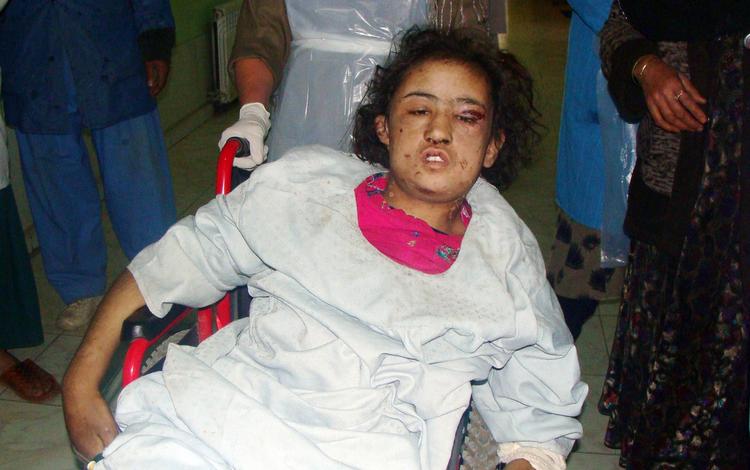 Tortur. Sahar Gu var stærkt medtaget, da hun blev fundet og bragt på hospitalet. 