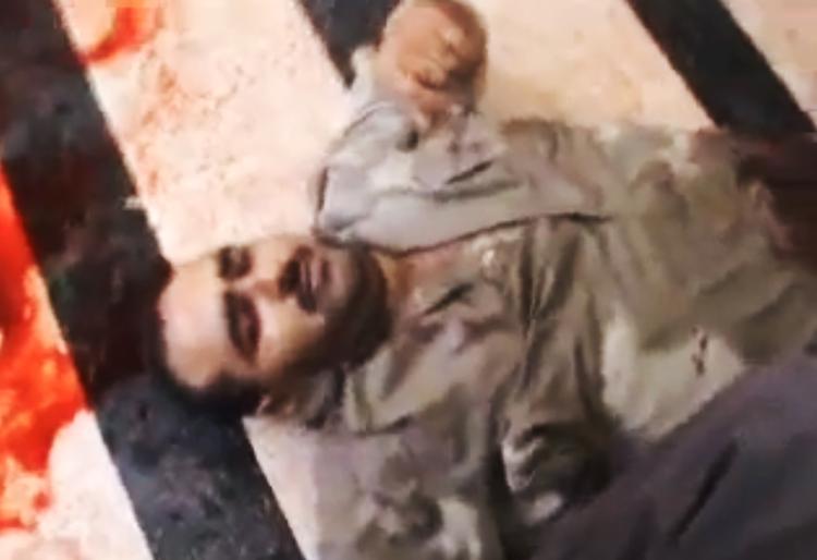 Farligt. En såret mand ses på en klinik i Idlib. Arbejdet med at operere og redde patienter er livsfarligt for læger i Syrien. 