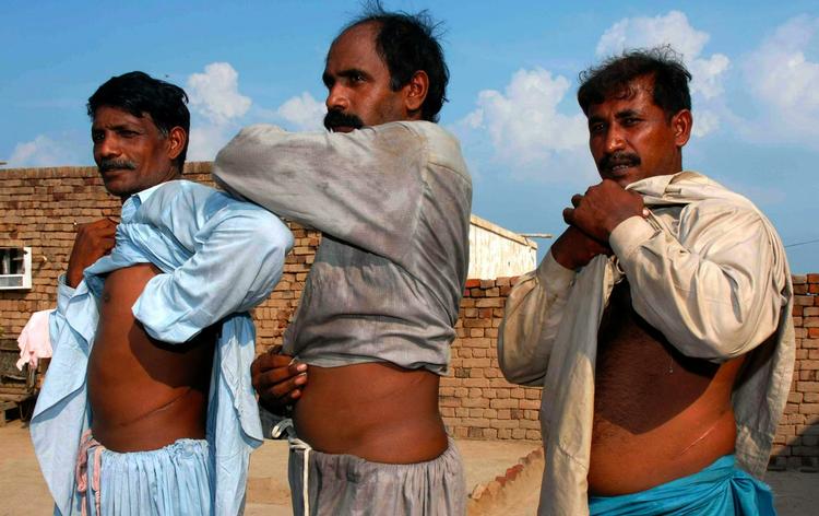 Organ-handel. Et stadigt stigende behov for organer nærer det sorte marked, vurderer Verdenssundhedsorganisationen, WHO. Blandt de lande, hvor handlen trives er Pakistan, som på billedet, og Indien. 