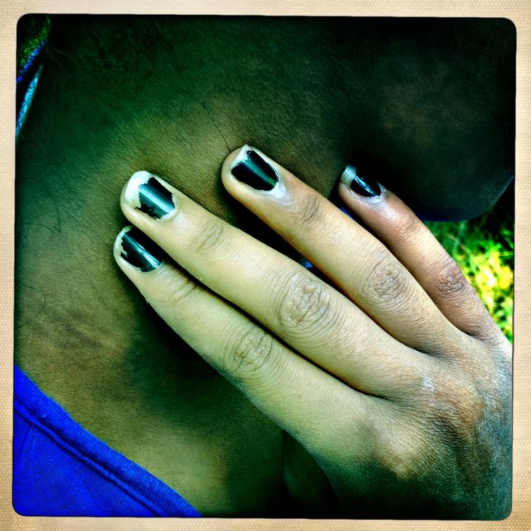 Omstridt. Ligesom Børns Vilkår har meldt Næstved Kommune til politiet for vold, har kommunen anmeldt plejefamilien for brud på deres kontrakt med kommunen. 