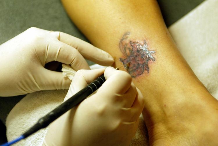 Hvis tatovøren bruger de forkerte farvestoffer kan det få livsfarlige konsekvenser, advarer læger. Alt for få tatovører fortæller, hvilke farver de bruger. 
