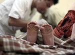 Indonesia Mass Circumcision