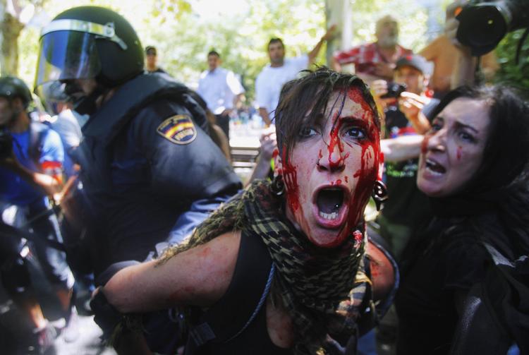43 er indtil videre kommet til skade under demonstrationerne. 