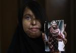 VANSIRING. Tidligere har syreangreb næsten udelukkende fundet sted i mellemøstlige og asiatiske lande. Denne pakistanske kvinde blev overhældt med syre i 2003, efter hun nægtede at gifte sig med sin undervisers ven. 