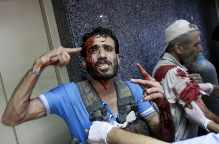 BLODBAD. Udover de mange døde, er tusindvis af mennesker også blevet såret i forbindelse med urolighederne i Syrien, der har stået på i mere end 17 måneder. 