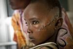 Flygtning. Ni-årige Jamila Yakobo blev såret af en machete, da hun flygtede fra uroligheder sammen med sin far. 