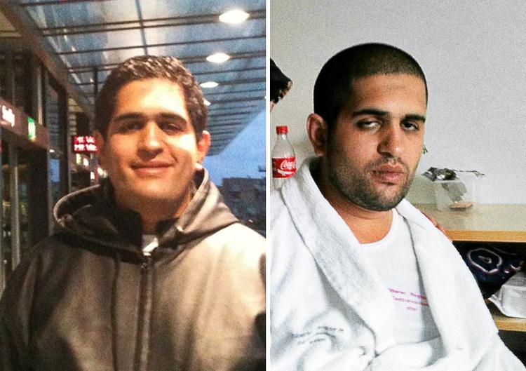 Bivirkninger. Til venstre ses et billede af Adel, taget under indlæggelsen inden han fik medicinen, der gav de voldsomme bivirkninger.  Billedet til højre er taget torsdag 9. juni 2011 - tre dage inden Adel døde og seks dage efter, at han begyndte på medicinen, der gav bivirkningerne. (Privatfoto) 