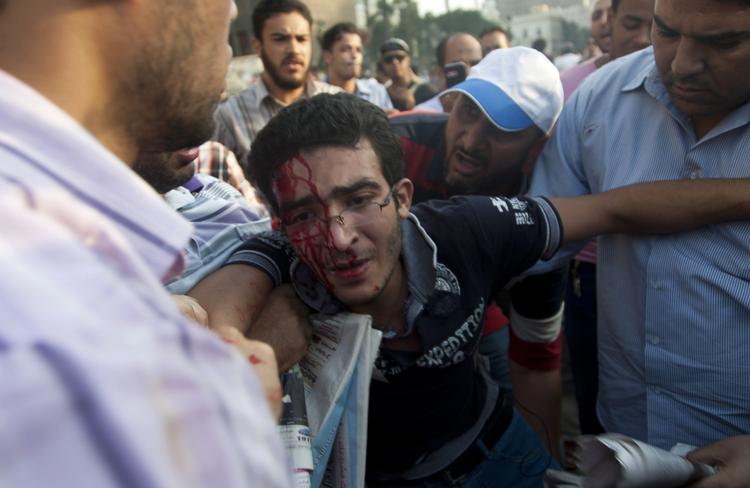 Uro. En såret mand hjælpes væk fra Tahrir-pladsen. 