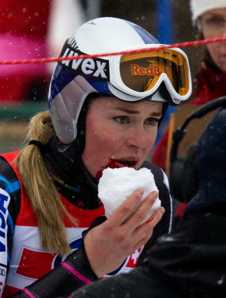 uheld. Lindsey Vonn forsøger efter et tidligere styrt at stoppe en blødning i munden ved at komme sne på området. 